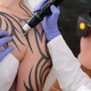 FDA Issues Warning on Certain OTC Analgesic Topical Products