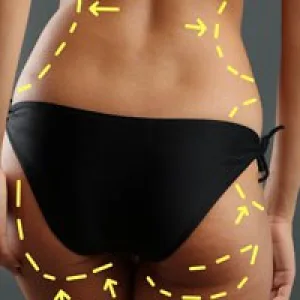 Men, New Technologies Drive Growth in Body Contouring Market