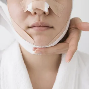 Rhinoplasty Surgery Selfies Trending