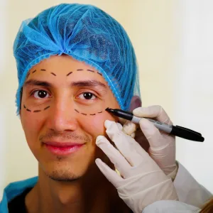 Strategic Blepharoplasty in the Male Patient