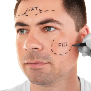 More Than 30 Percent of Men Are Considering Nips and Tucks