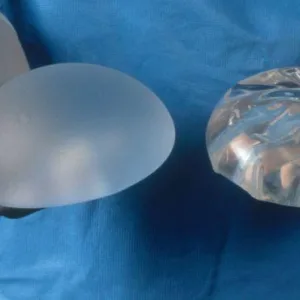 Breast Implant Register Launches