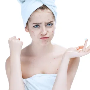 Researchers Discover Lipids Linked to Teen Acne