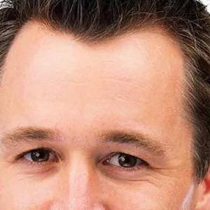 No Brow Lifts for 'Handsome' Men