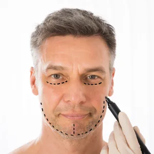 The Male Facelift Patient is Different