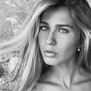 Solving Pigmentation Issues, From An Esthetician’s POV