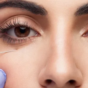 Fillers Are the Future