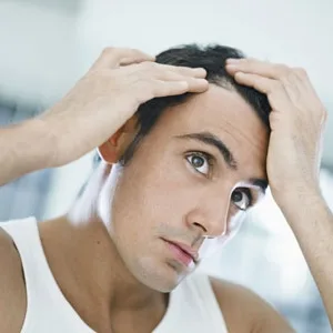 Demand For Hair Restoration Surgeries Increased In 2016