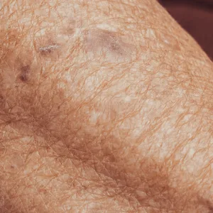 Mayo Clinic Shares Longevity Framework for Skin Aging: "Skinspan"