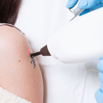 Equipment no Parallax Template