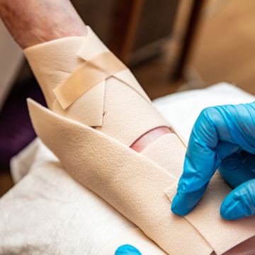 Amspa epidermolysis bullosa 122123