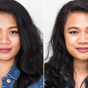 Jesa nose job before after