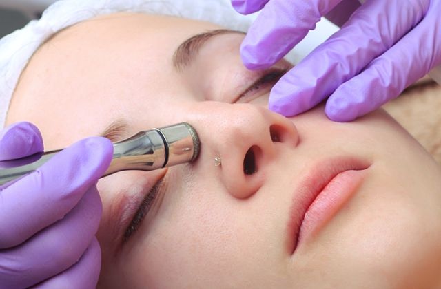 Dermabrasion