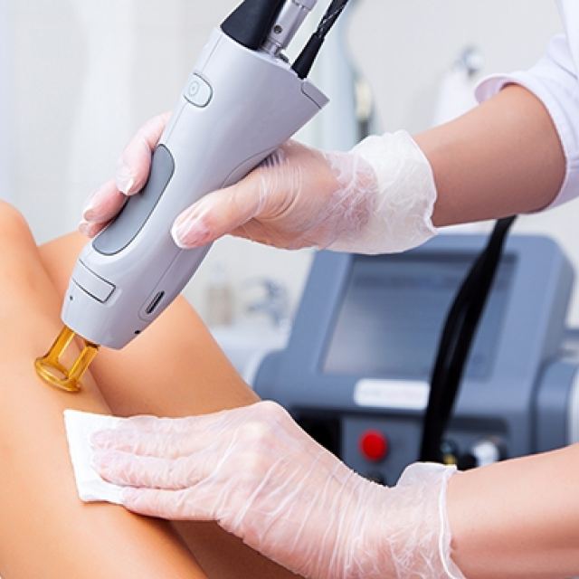Amspa laser hair removal 051
