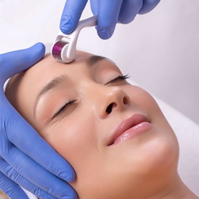 Amspa microneedling 091719