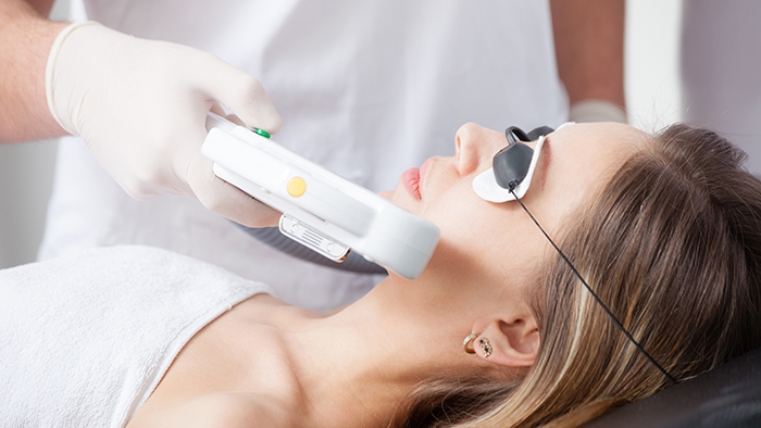 Laser treatment administered to jawline