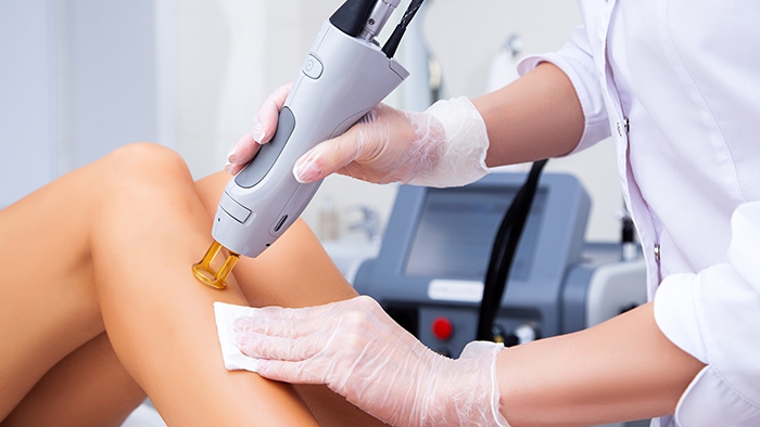 Laser hair removal treatment